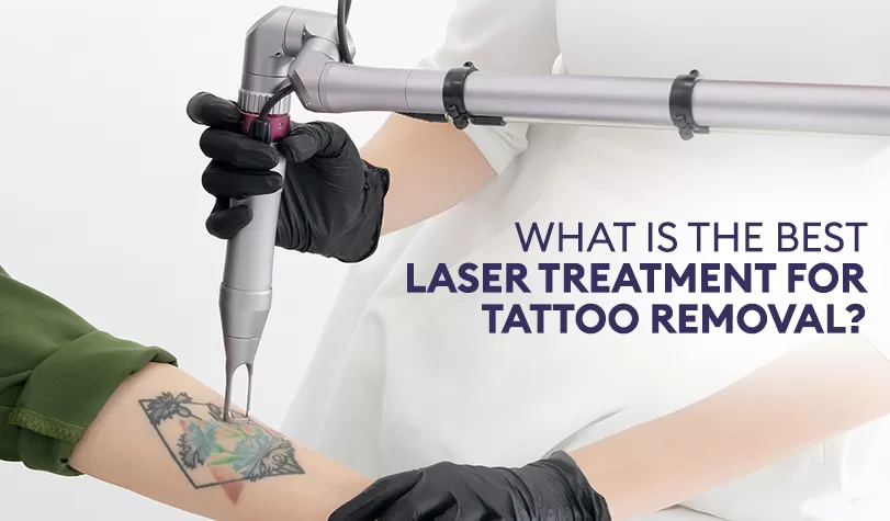 How Laser Tattoo Removal Affects Body Hair